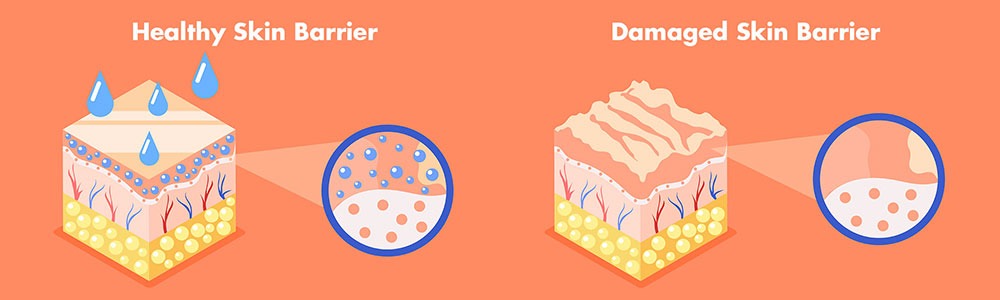 Understanding Barrier Repair And Its Skin Benefits: Ultimate Glow Guide